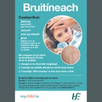 HSE Measles Bruitneach website thumbnail image 22 02 2024 